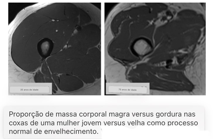 Proporção massa corporal pa longevidade