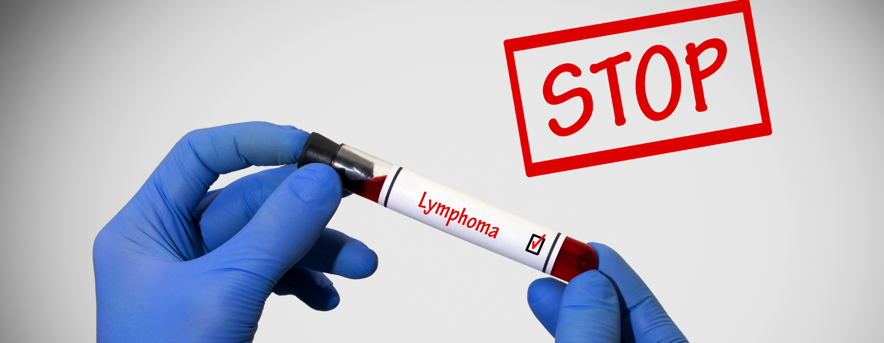 linfoma