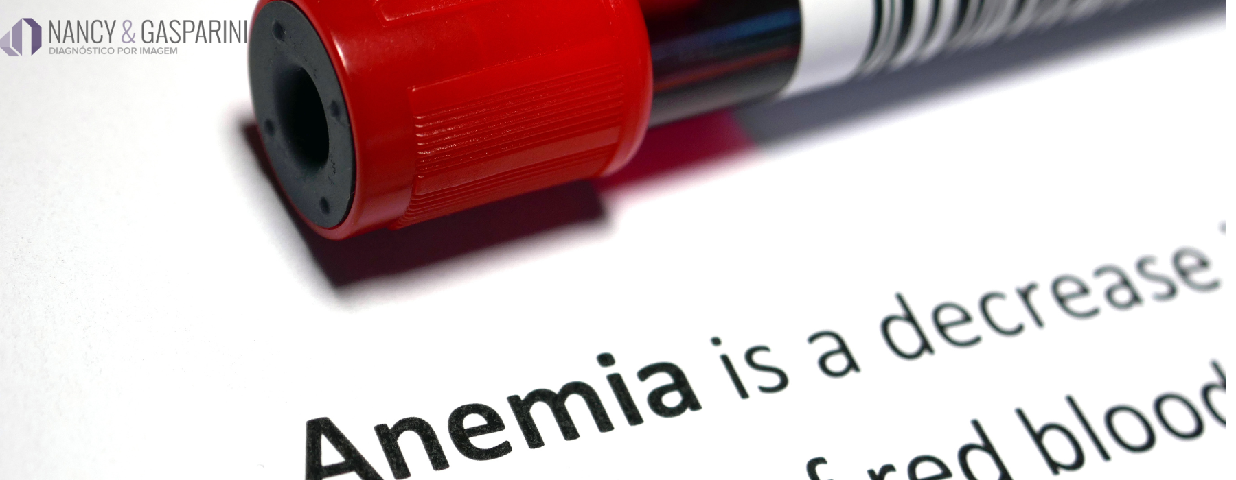 anemia na gestação